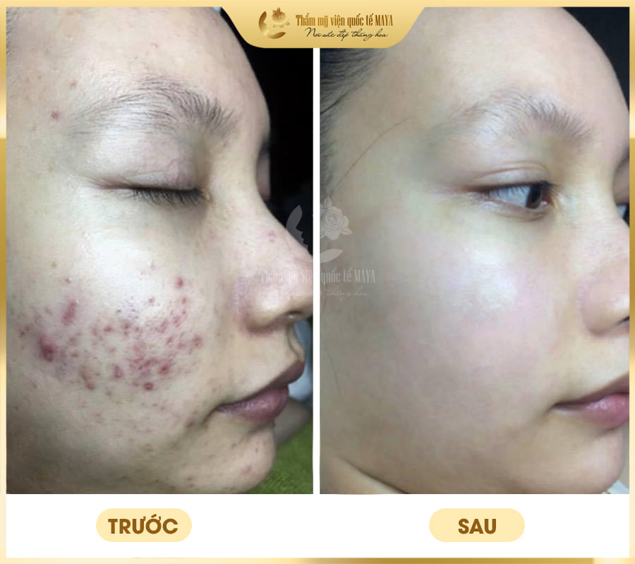 Hình ảnh khách hàng trước và sau